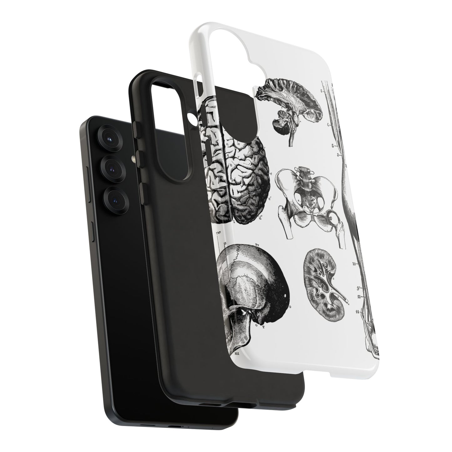 Vintage Anatomy Phone Case - Medical Sketch Design - Custom iPhone, Samsung & Pixel Cover - Science Gift - Doctor Aesthetic - Anatomy case