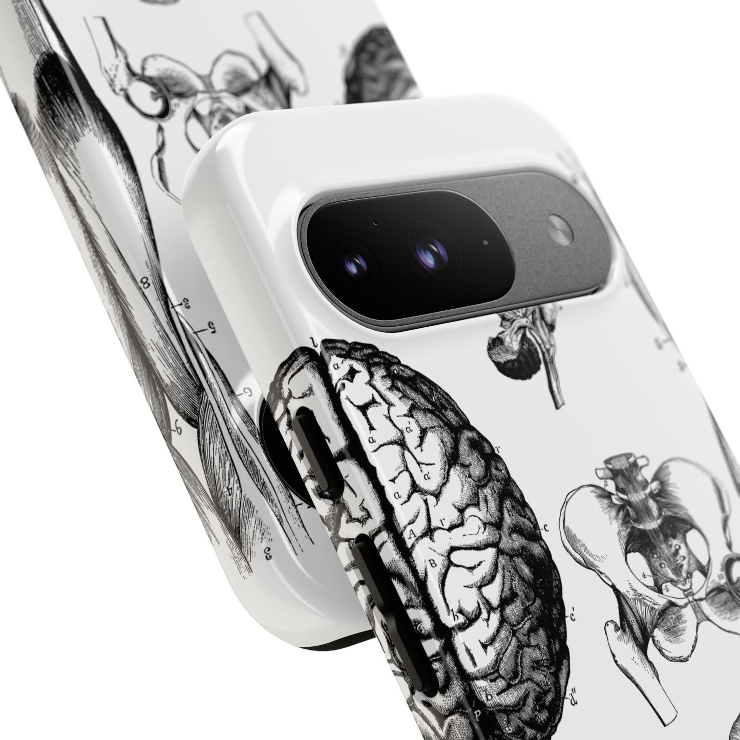 Vintage Anatomy Phone Case - Medical Sketch Design - Custom iPhone, Samsung & Pixel Cover - Science Gift - Doctor Aesthetic - Anatomy case