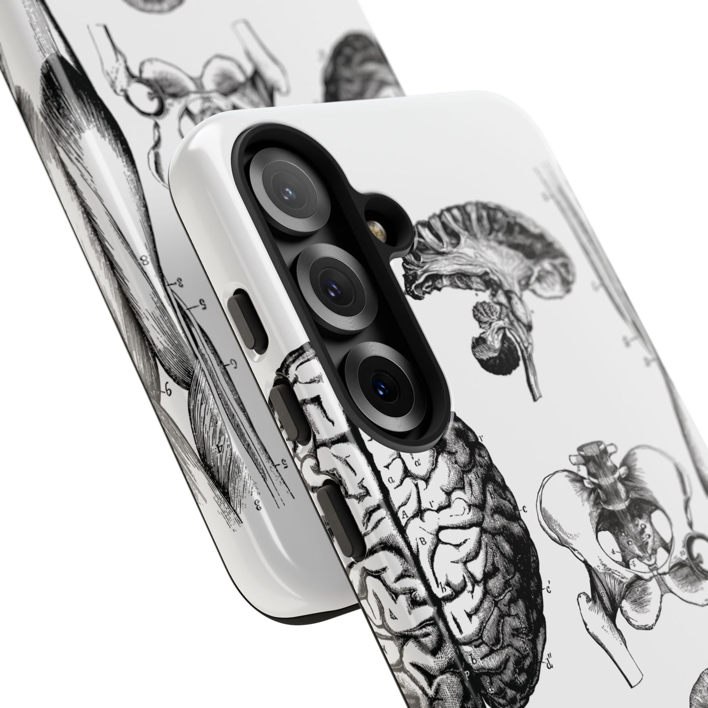 Vintage Anatomy Phone Case - Medical Sketch Design - Custom iPhone, Samsung & Pixel Cover - Science Gift - Doctor Aesthetic - Anatomy case