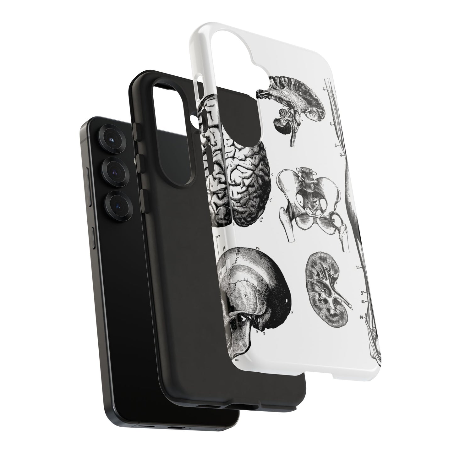 Vintage Anatomy Phone Case - Medical Sketch Design - Custom iPhone, Samsung & Pixel Cover - Science Gift - Doctor Aesthetic - Anatomy case