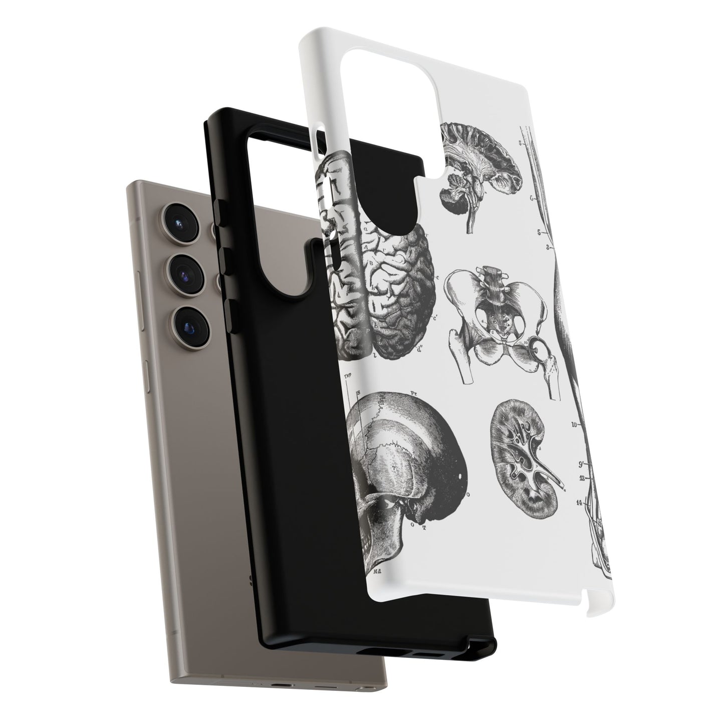 Vintage Anatomy Phone Case - Medical Sketch Design - Custom iPhone, Samsung & Pixel Cover - Science Gift - Doctor Aesthetic - Anatomy case