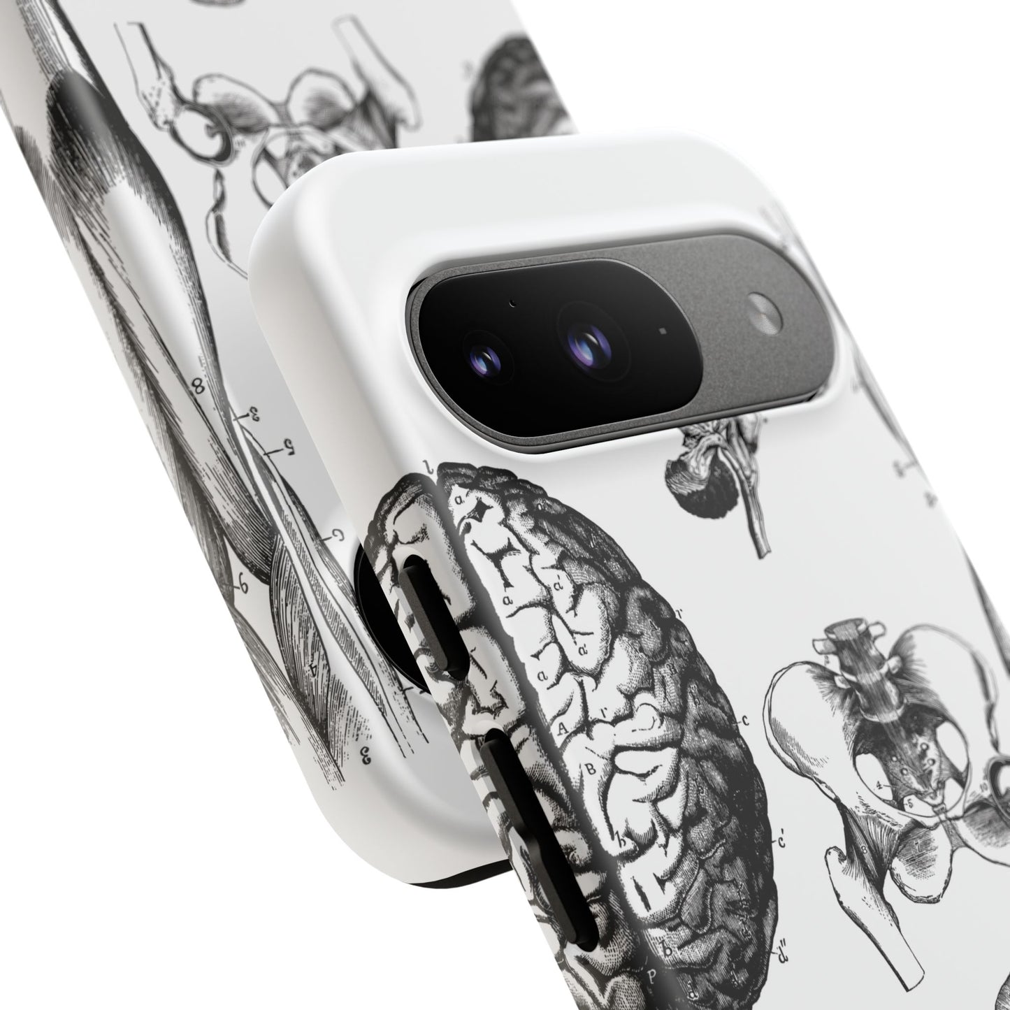 Vintage Anatomy Phone Case - Medical Sketch Design - Custom iPhone, Samsung & Pixel Cover - Science Gift - Doctor Aesthetic - Anatomy case