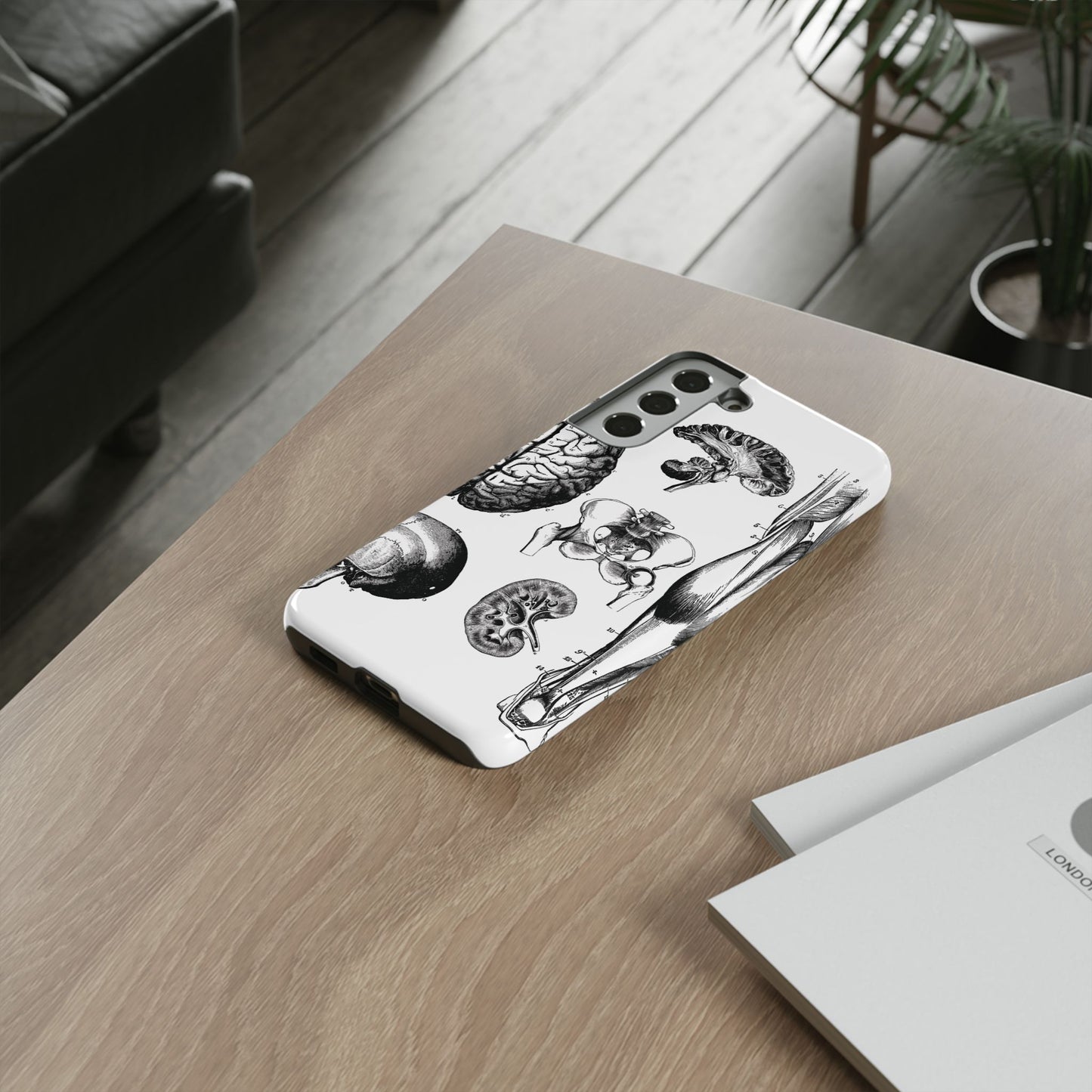 Vintage Anatomy Phone Case - Medical Sketch Design - Custom iPhone, Samsung & Pixel Cover - Science Gift - Doctor Aesthetic - Anatomy case