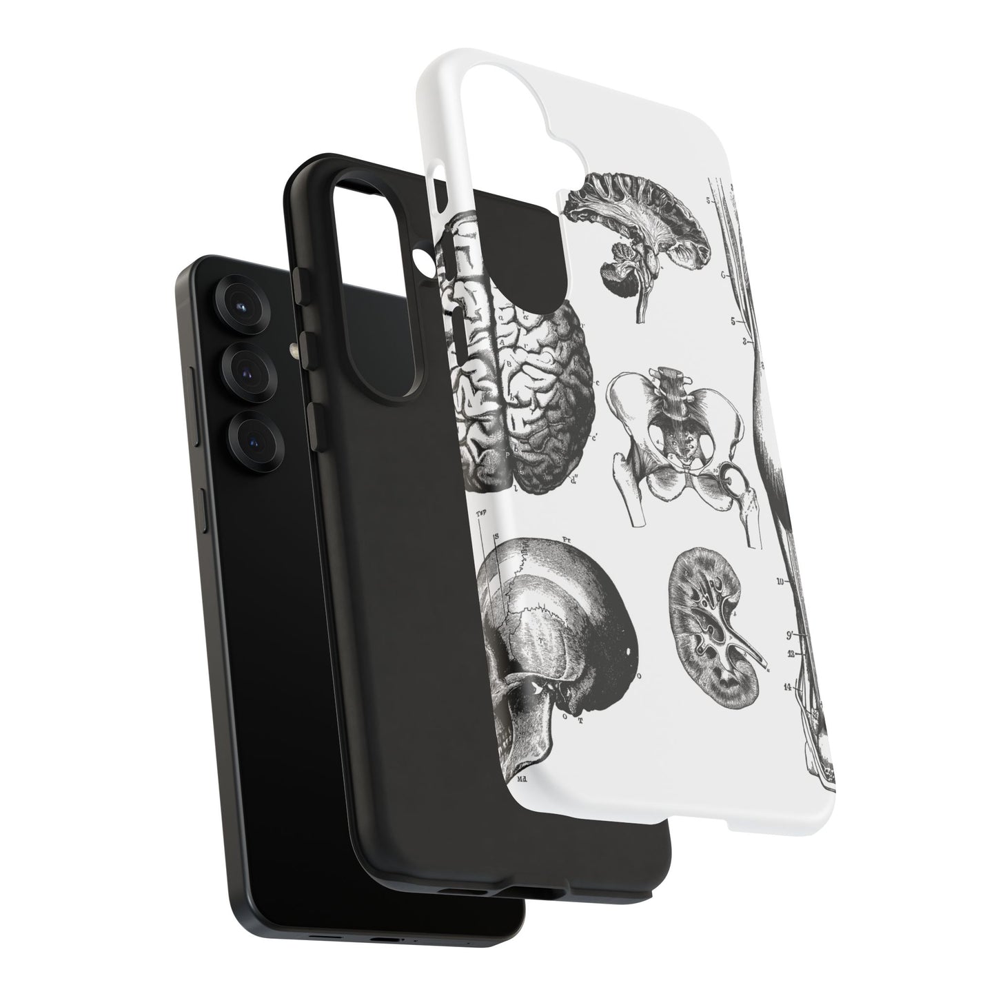 Vintage Anatomy Phone Case - Medical Sketch Design - Custom iPhone, Samsung & Pixel Cover - Science Gift - Doctor Aesthetic - Anatomy case