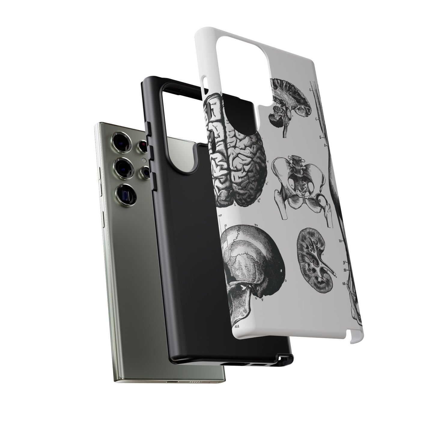 Vintage Anatomy Phone Case - Medical Sketch Design - Custom iPhone, Samsung & Pixel Cover - Science Gift - Doctor Aesthetic - Anatomy case