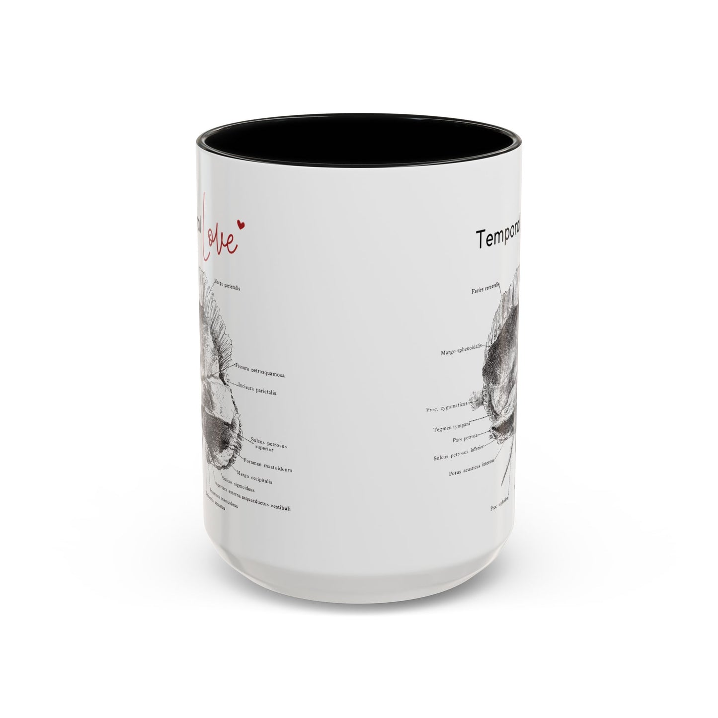 Temporal love Anatomy Lovers Club Coffee Mug, Medical Humor, Gift for Science Lovers, Unique Anatomical Design, Black Accent Mug
