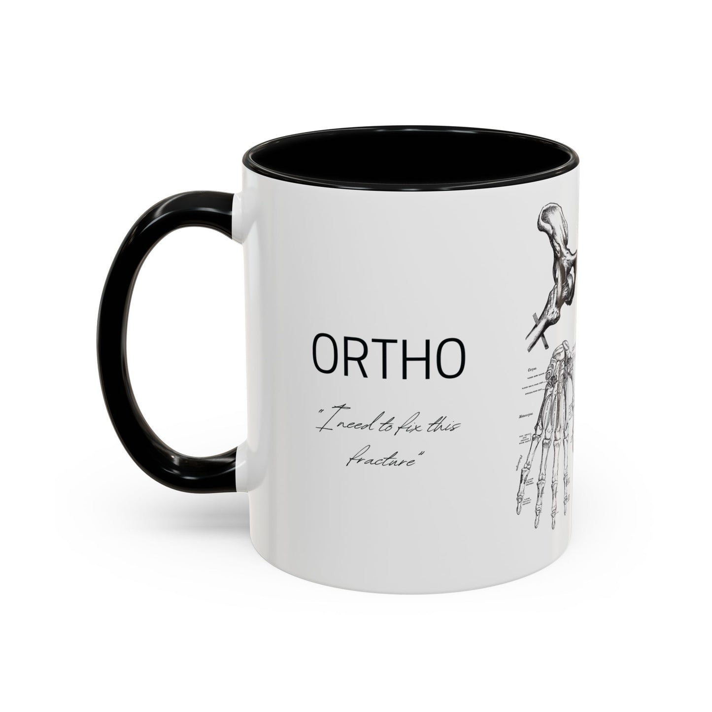 Orthopedic Surgery Mug, Bone Anatomy Coffee Cup, Orthopedist Gift Idea, Medical Anatomy Mug, Doctor Appreciation, Healthcare Worker Gift