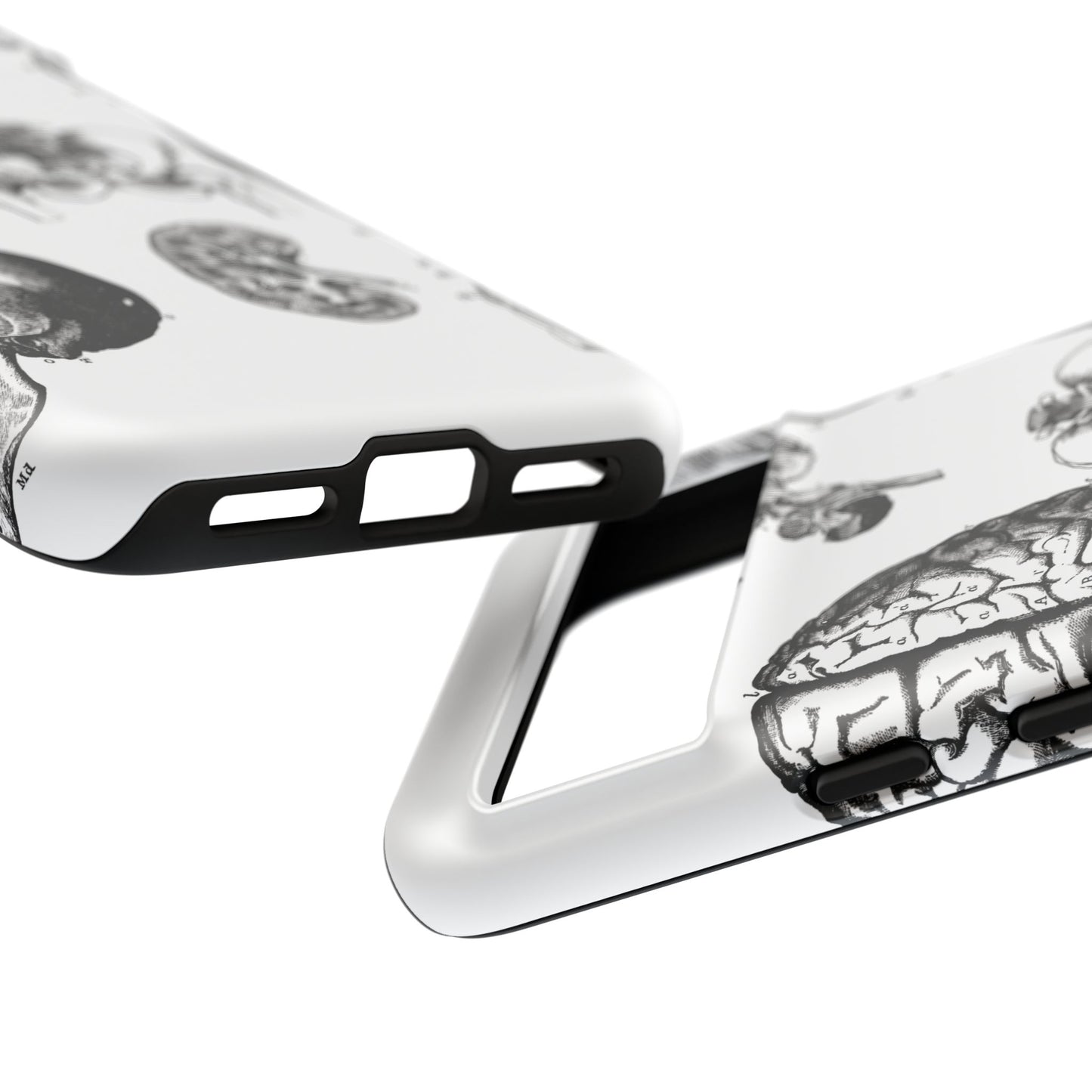 Vintage Anatomy Phone Case - Medical Sketch Design - Custom iPhone, Samsung & Pixel Cover - Science Gift - Doctor Aesthetic - Anatomy case