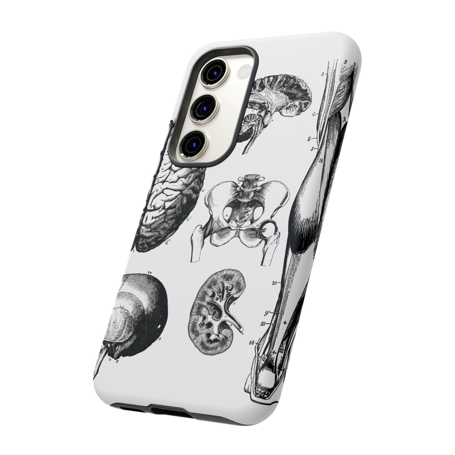 Vintage Anatomy Phone Case - Medical Sketch Design - Custom iPhone, Samsung & Pixel Cover - Science Gift - Doctor Aesthetic - Anatomy case