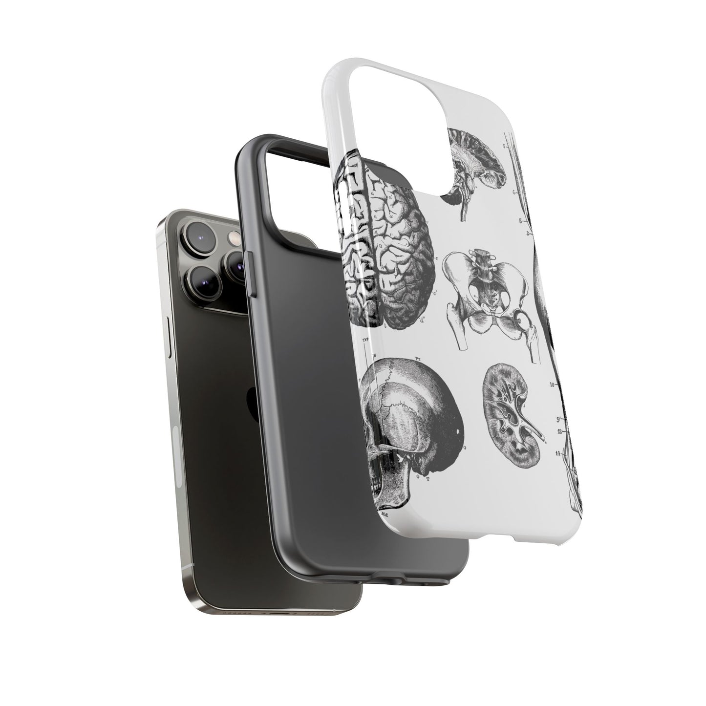 Vintage Anatomy Phone Case - Medical Sketch Design - Custom iPhone, Samsung & Pixel Cover - Science Gift - Doctor Aesthetic - Anatomy case