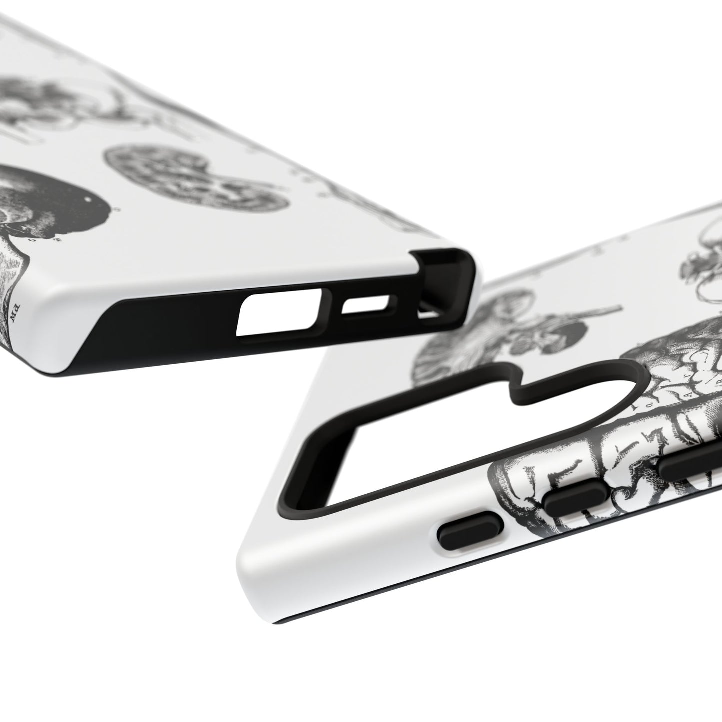 Vintage Anatomy Phone Case - Medical Sketch Design - Custom iPhone, Samsung & Pixel Cover - Science Gift - Doctor Aesthetic - Anatomy case