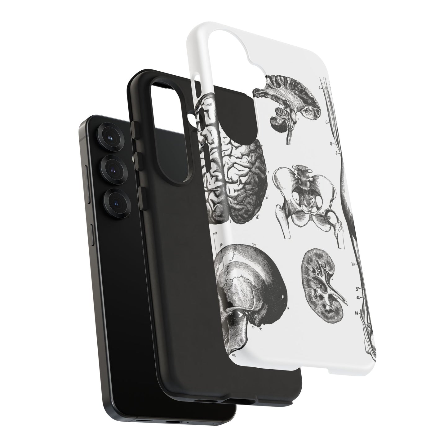 Vintage Anatomy Phone Case - Medical Sketch Design - Custom iPhone, Samsung & Pixel Cover - Science Gift - Doctor Aesthetic - Anatomy case