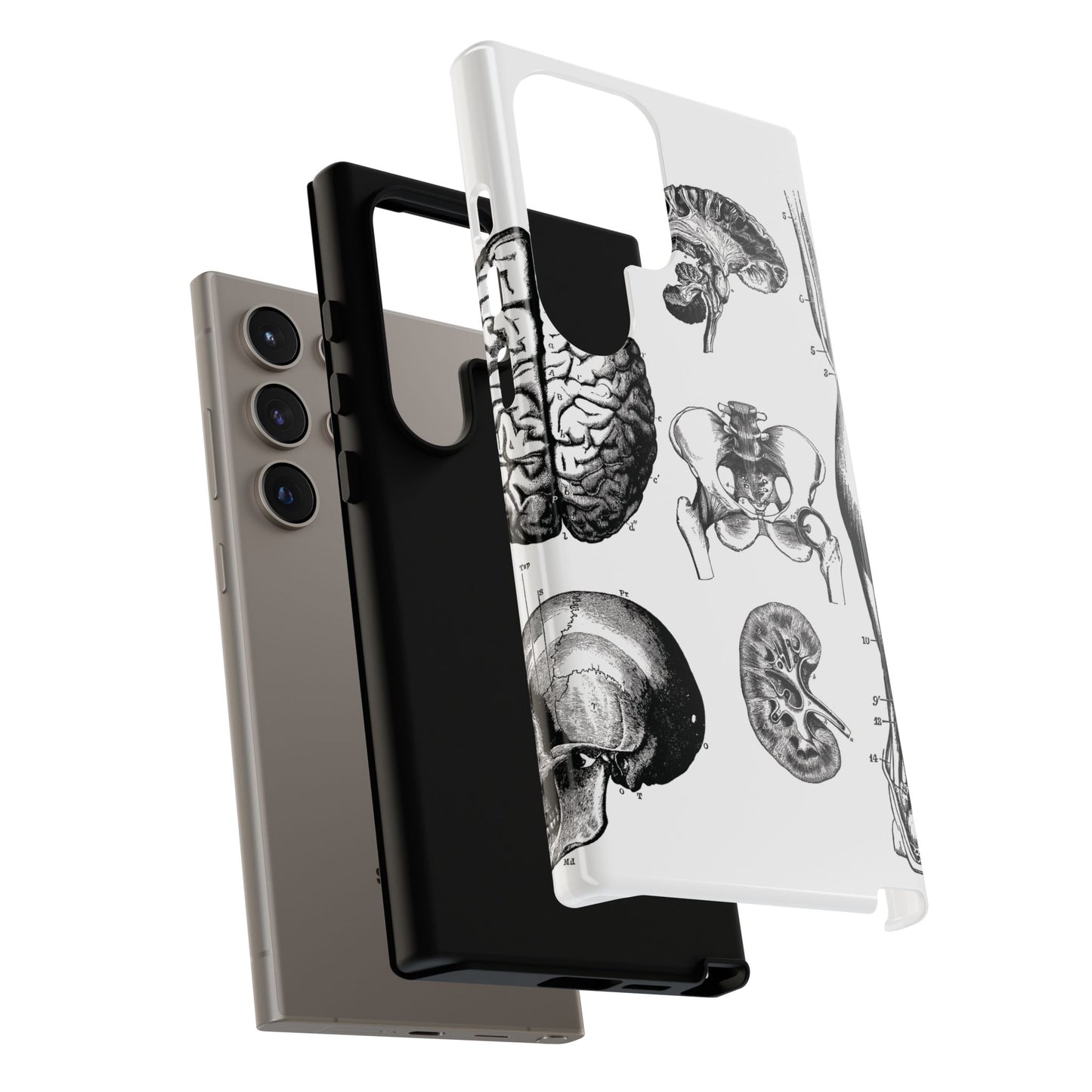 Vintage Anatomy Phone Case - Medical Sketch Design - Custom iPhone, Samsung & Pixel Cover - Science Gift - Doctor Aesthetic - Anatomy case