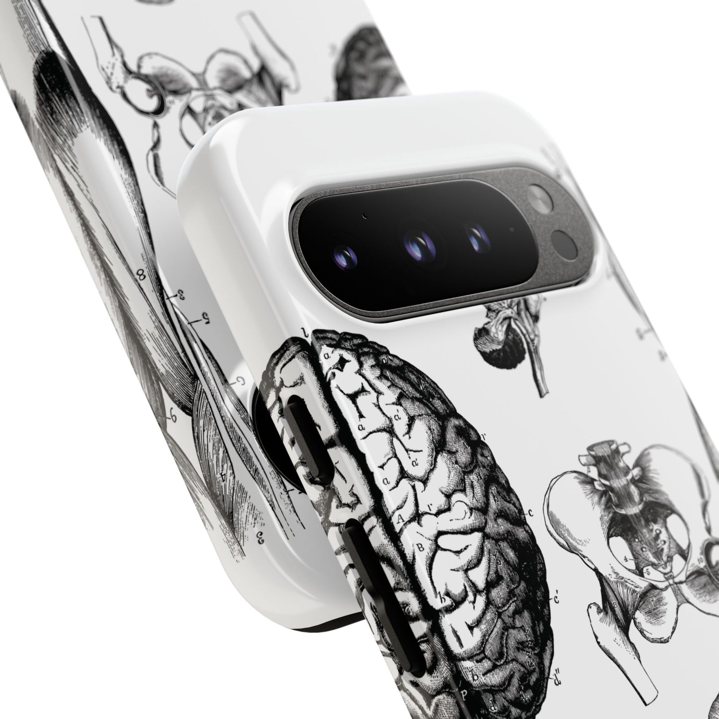 Vintage Anatomy Phone Case - Medical Sketch Design - Custom iPhone, Samsung & Pixel Cover - Science Gift - Doctor Aesthetic - Anatomy case