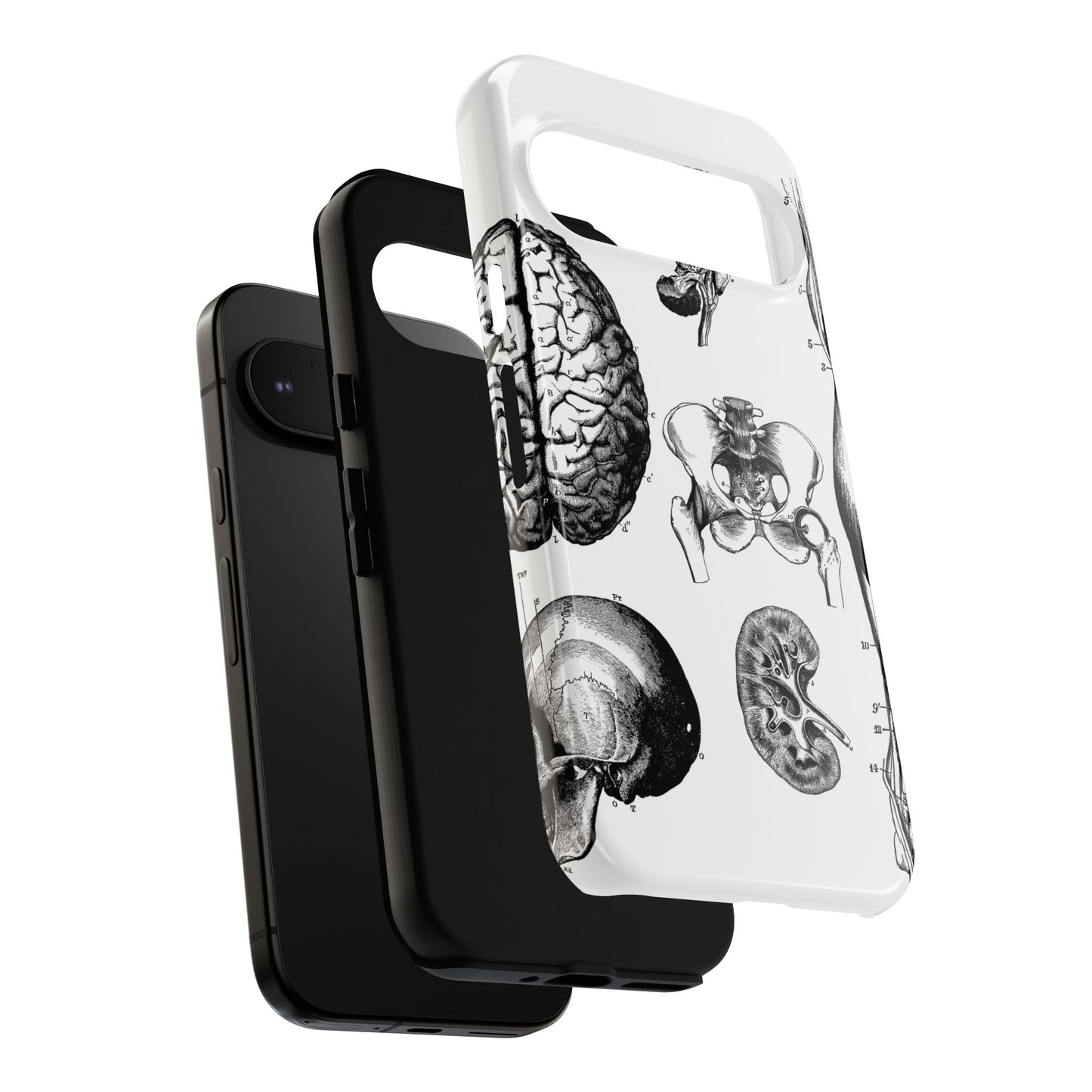 Vintage Anatomy Phone Case - Medical Sketch Design - Custom iPhone, Samsung & Pixel Cover - Science Gift - Doctor Aesthetic - Anatomy case