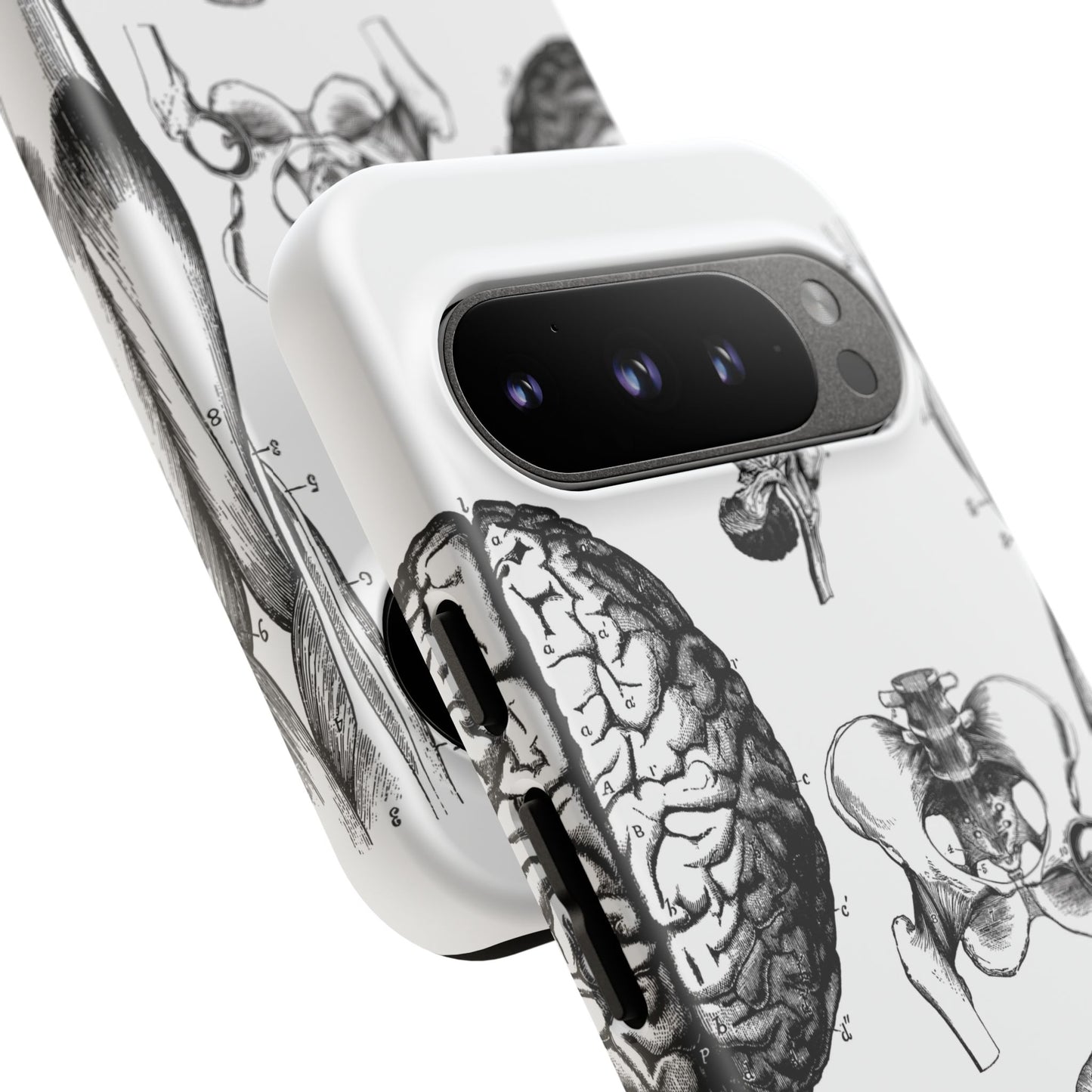 Vintage Anatomy Phone Case - Medical Sketch Design - Custom iPhone, Samsung & Pixel Cover - Science Gift - Doctor Aesthetic - Anatomy case