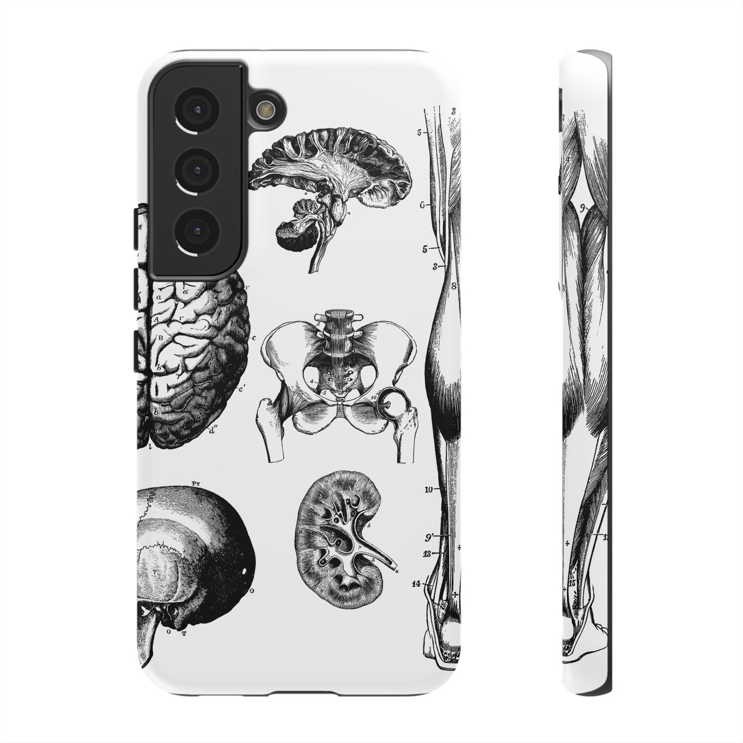 Vintage Anatomy Phone Case - Medical Sketch Design - Custom iPhone, Samsung & Pixel Cover - Science Gift - Doctor Aesthetic - Anatomy case