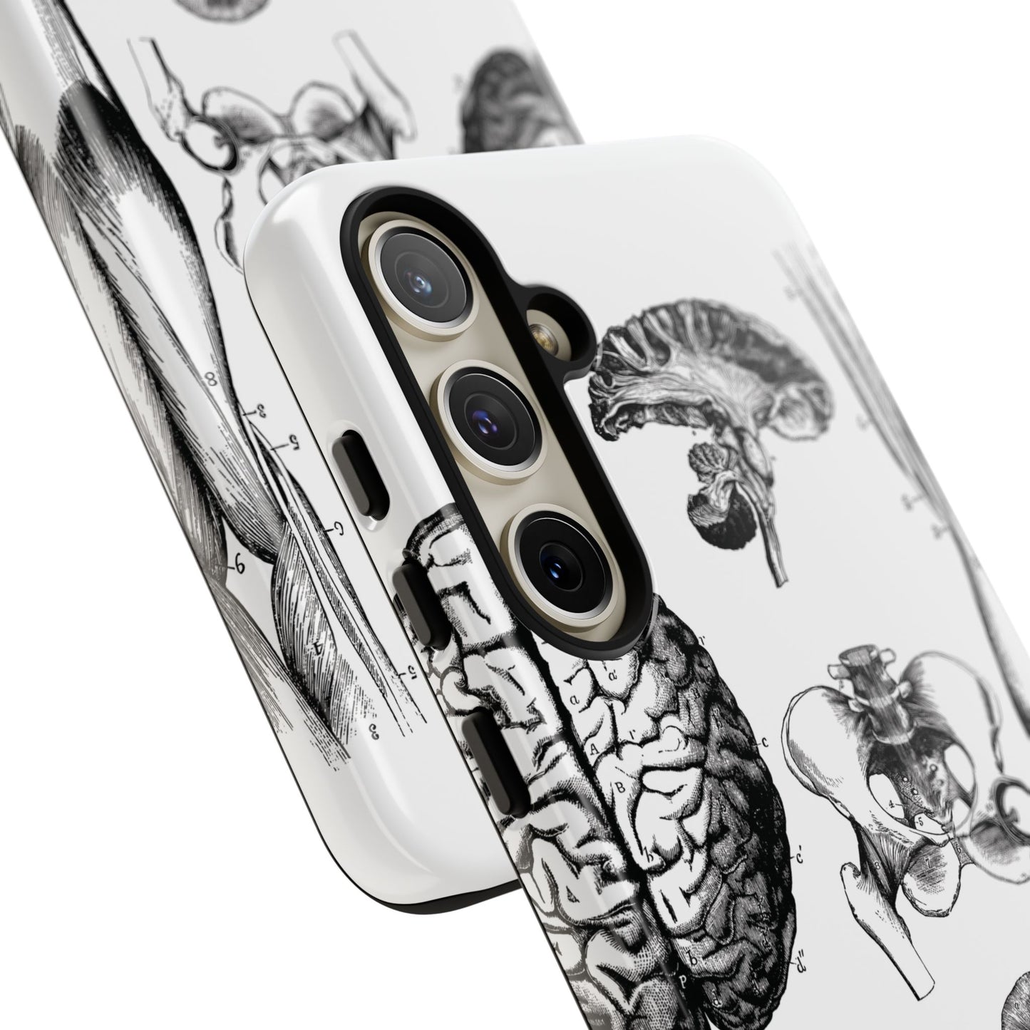 Vintage Anatomy Phone Case - Medical Sketch Design - Custom iPhone, Samsung & Pixel Cover - Science Gift - Doctor Aesthetic - Anatomy case