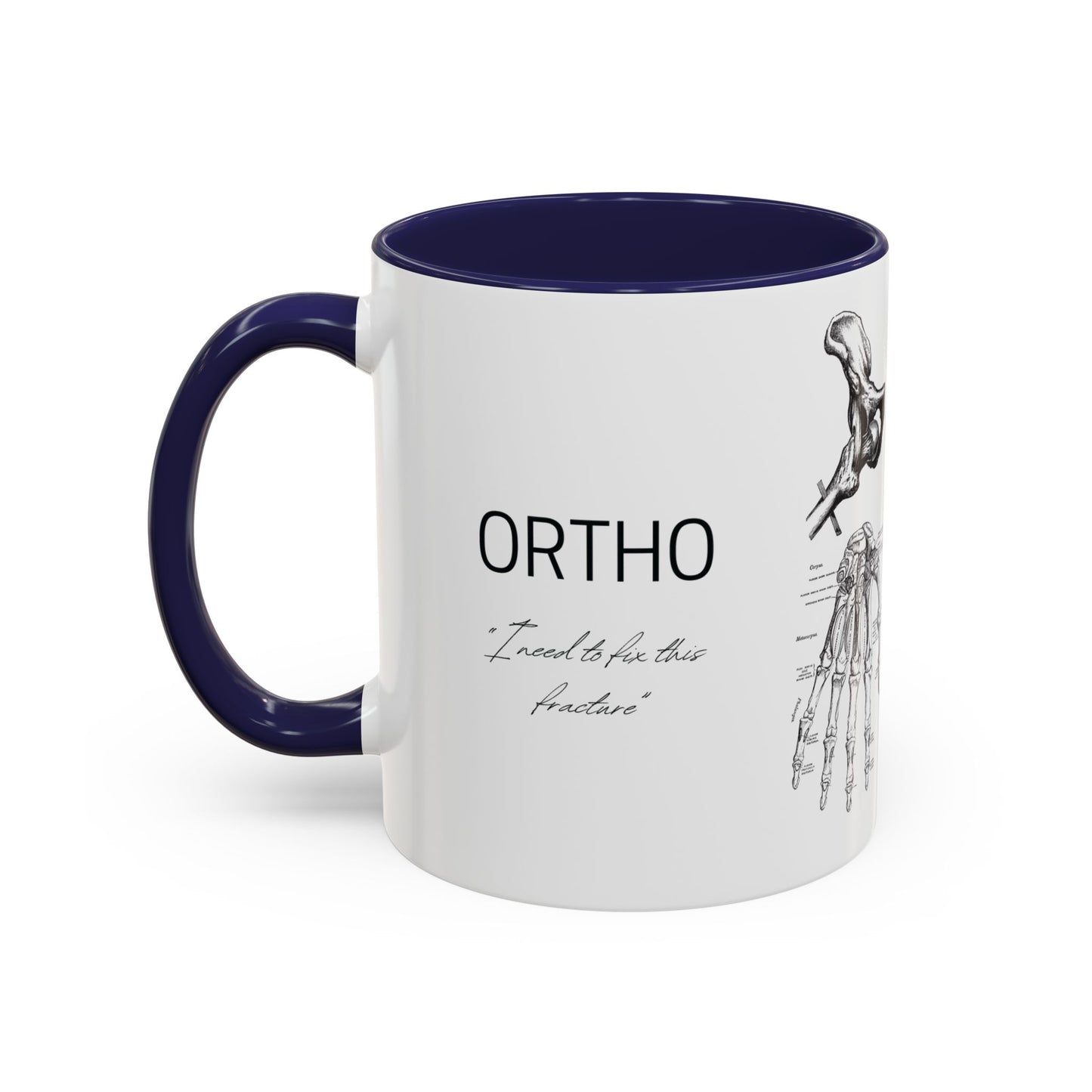 Orthopedic Surgery Mug, Bone Anatomy Coffee Cup, Orthopedist Gift Idea, Medical Anatomy Mug, Doctor Appreciation, Healthcare Worker Gift