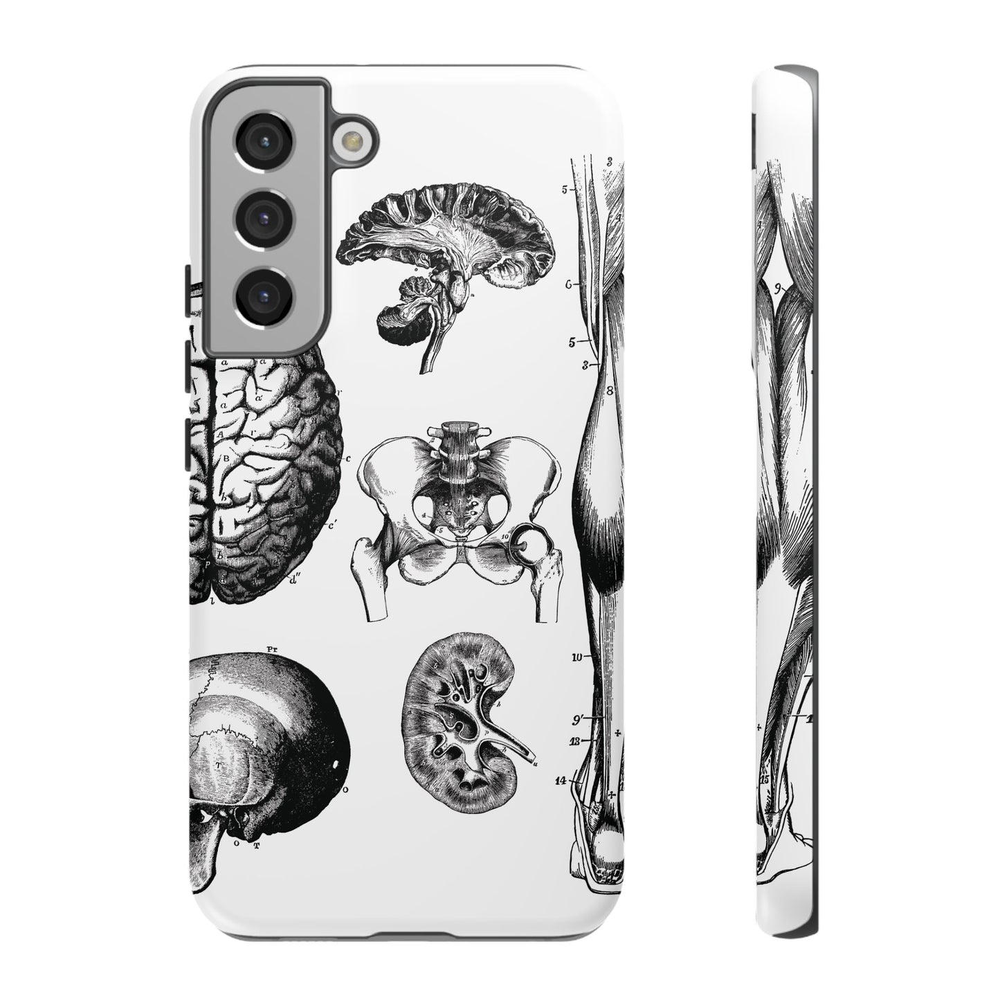 Vintage Anatomy Phone Case - Medical Sketch Design - Custom iPhone, Samsung & Pixel Cover - Science Gift - Doctor Aesthetic - Anatomy case